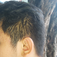 reborn-help-rambut-gua-rontok-hampir-botak---part-1