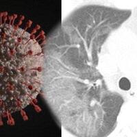 ternyata-virus-corona-cuma-quottidurquot-di-tubuh-pasien-yang-sudah-sembuh-gan