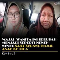 wajah-wanita-ini-berubah-menjadi-seperti-nenek-nenek-karena-hamil-anak-ketiga