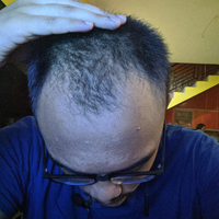 reborn-help-rambut-gua-rontok-hampir-botak---part-1