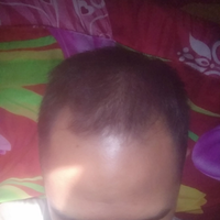 reborn-help-rambut-gua-rontok-hampir-botak---part-1