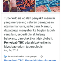 pemerintah-sukes-pakai-mesin-pendeteksi-tb-untuk-periksa-covid-19-apa-untungnya