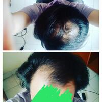 reborn-help-rambut-gua-rontok-hampir-botak---part-1