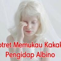 potret-potret-memukau-dari-kakak-beradik-yang-mengidap-albino