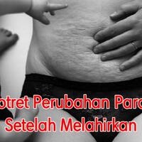 potret-potret-perubahan-para-wanita-setelah-melahirkan