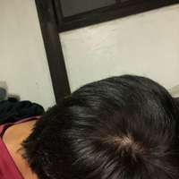 reborn-help-rambut-gua-rontok-hampir-botak---part-1