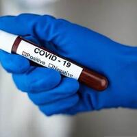 bin-temukan-651-orang-positif-covid-19-di-surabaya