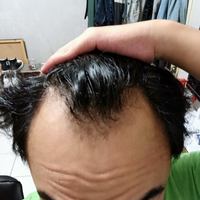 reborn-help-rambut-gua-rontok-hampir-botak---part-1