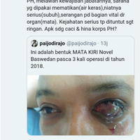 dagelan-hukum-jpu-rasa-pembela-di-sidang-novel