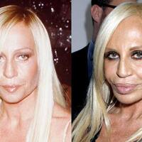 hidung-pesek-itu-istimewa-benarkah