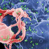 human-immunodeficiency-virus-berbahaya-takterlihat-belum-ada-obatnya