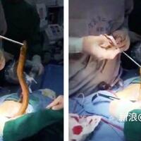 hati-hati-hewan-hewan-ini-bersarang-dalam-tubuh-manusia