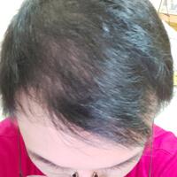 reborn-help-rambut-gua-rontok-hampir-botak---part-1