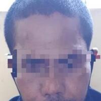selain-aniaya-istri-pakai-parang-ayah-ini-tega-potong-bibir-anak-sendiri