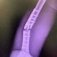 post-image