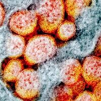 malaysia-sebut-temukan-mutasi-virus-corona-yang-lebih-menular-10-kali-lipat