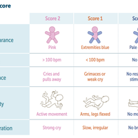 apa-itu-apgar-score-metode-yang-sering-digunakan-pada-persalinan