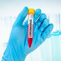 tambah-2197-kasus-corona-di-ri-per-21-agustus-jadi-149408