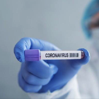 beberapa-pegawai-positif-corona-kantor-kementan-lockdown