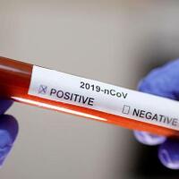 alat-tes-error-ribuan-orang-di-swedia-keliru-diagnosis-covid-19