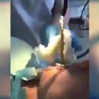 mengerikan-viral-video-wanita-saat-makhluk-diduga-ular-dikeluarkan-dari-mulutnya