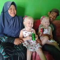 anak-bule-kembar-lahir-dari-orang-tua-asal-jawa-sering-dikira-pengasuhnya