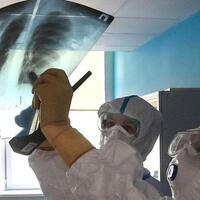 kabar-baik-kerusakan-paru-paru-dan-jantung-akibat-corona-sembuh-seiring-waktu