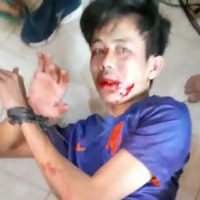 breaking-news-syekh-ali-jaber-dikabarkan-kena-tusuk-saat-berdakwah-di-bandar-lampung