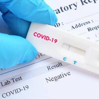 hasil-rapid-test-positif--negatif-itu-semua-palsu-alat-itu-bukan-rekomendasi-idiquot