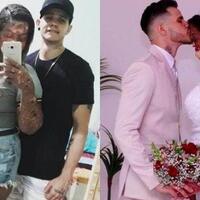 cinta-tidak-melulu-soal-fisik-wanita-kelainan-kulit-langka-di-nikahi-pria-tampan