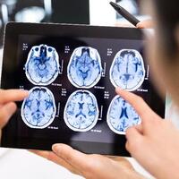 mengenal-infeksi-langka-yang-disebabkan-amoeba-pemakan-otak