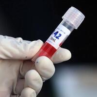 pecah-rekor-ini-sebaran-4510-pasien-corona-yang-sembuh-30-september