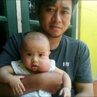butuh-bantuan-donasi-buat-anak-kena-tumor-pipi-sejak-lahir