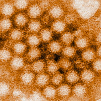 5-fakta-tentang-norovirus-virus-lama-yang-muncul-kembali