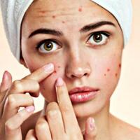 7-perawatan-tepat-untuk-si-pemilik-kulit-berjerawat