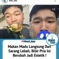 makan-madu-langsung-dari-sarangnya-seketika-bibir-pria-ini-berubah