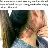 tragis-gadis-ini-tewas-kesedak-knl-di-malam-tahun-baru