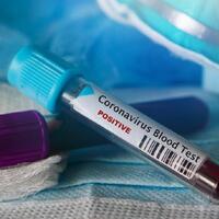 ini-sebaran-rekor-14518-kasus-corona-jabar-ngegas-di-4601