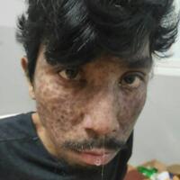 rahasiakan-penyakit-ustadz-maaher-polri-bisa-mencoreng-nama-baik-keluarga