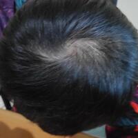 reborn-help-rambut-gua-rontok-hampir-botak---part-1