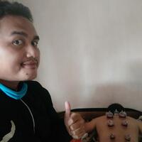 pengalaman-pertama-tertusuk-jarum-bekam