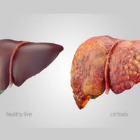 jaga-kesehatan-organ-hati-lakukan-deteksi-dini-dan-kenali-gejalanya