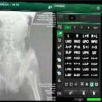 sembunyikan-sabu-05-kg-di-dalam-anus-2-remaja-diringkus-polda-ntb