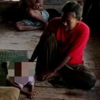 dear-pemerintah-bayi-usia-20-bulan-asal-cianjur-menderita-gizi-buruk