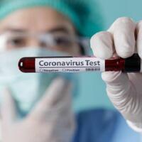 kasus-covid-19-di-ciracas-menurun-dari-36-menjadi-tersisa-11-orang