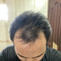 reborn-help-rambut-gua-rontok-hampir-botak---part-1