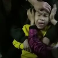 croup-gangguan-pernafasan-pada-anak-yang-akibatkan-penderitanya-batuk-menggonggong