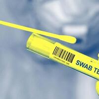 waspada-puluhan-tempat-rapid-tes-antigen-di-kota-padang-ternyata-tak-berizin
