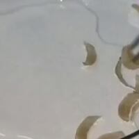 ingin-tahu-sebanyak-apa-bakteri-dalam-kuku-ini-dia-video-penampakan-dan-bahayanya