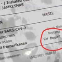 ngeri-ngeri-sedap-makan-gorengan-bungkusnya-bekas-hasil-tes-covid-19-positif